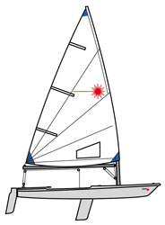 Laser Radial